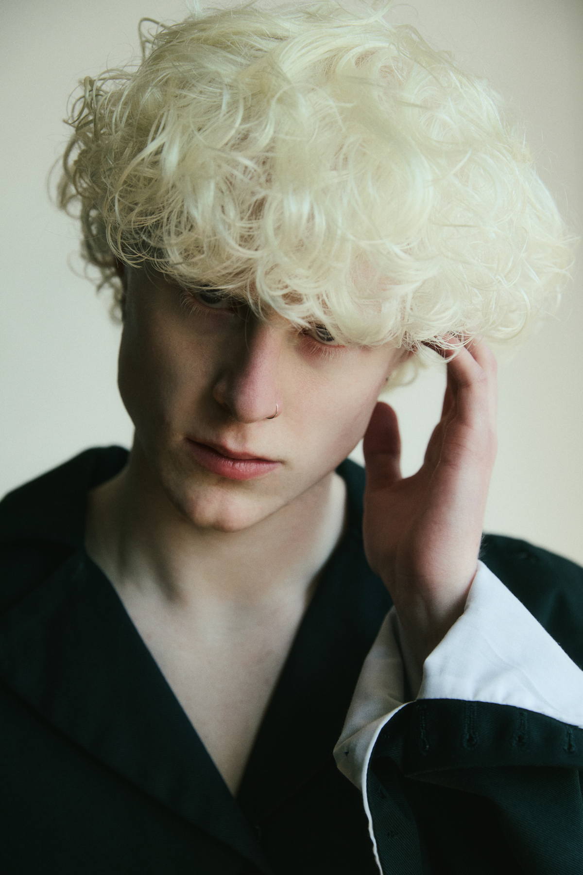 fashion editorial Albinism