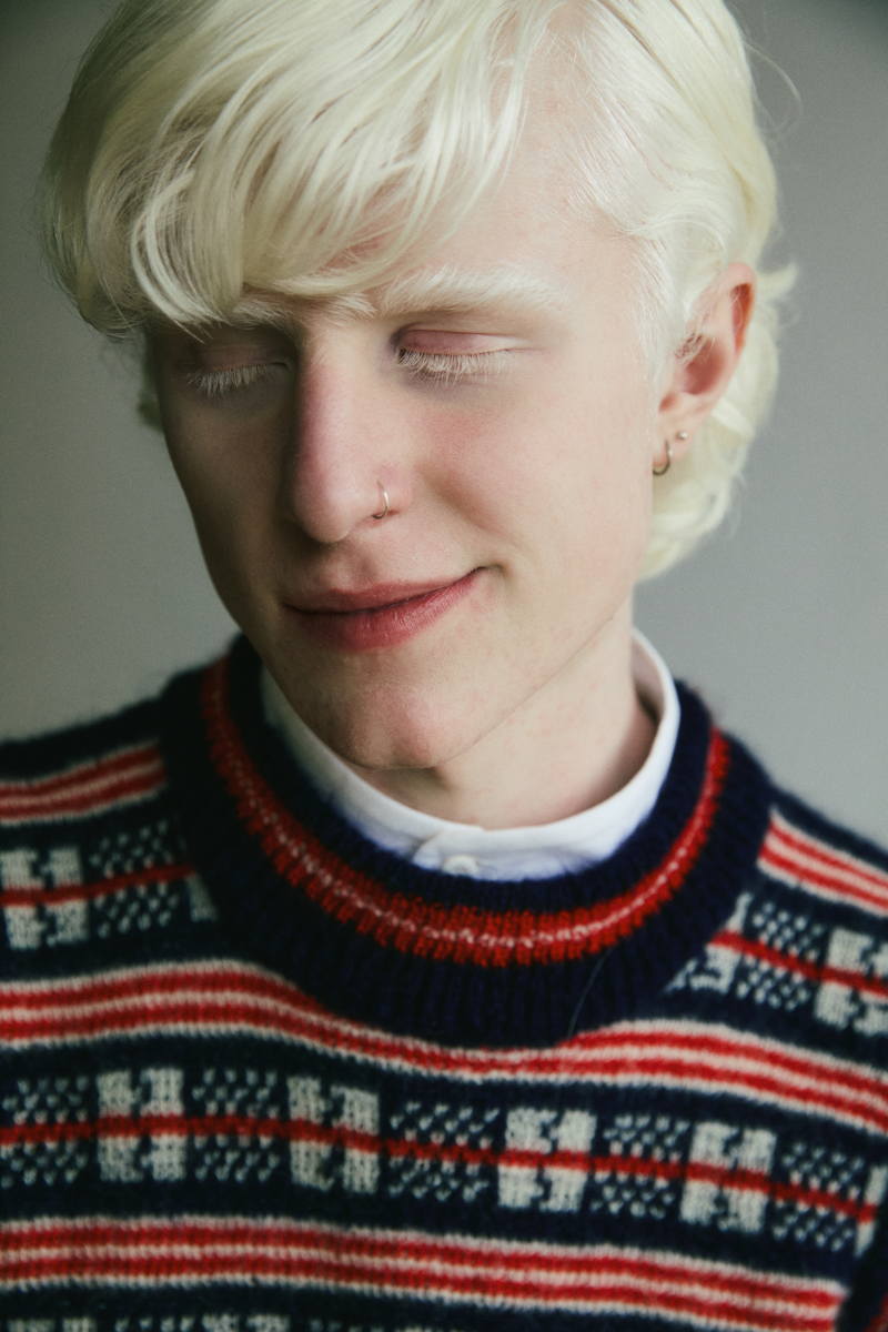 fashion editorial about the beauty of albinism