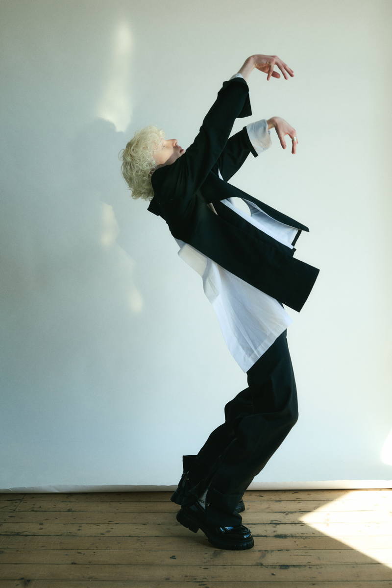 Fashion editorial about the beauty of albinism